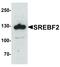 Sterol Regulatory Element Binding Transcription Factor 2 antibody, LS-B12146, Lifespan Biosciences, Western Blot image 