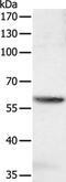 Suppressor Of Cytokine Signaling 7 antibody, PA5-50263, Invitrogen Antibodies, Western Blot image 