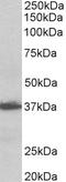 Aminoacyl TRNA Synthetase Complex Interacting Multifunctional Protein 1 antibody, STJ72797, St John