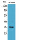 Carbonic Anhydrase 4 antibody, STJ96493, St John
