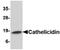 Cathelicidin Antimicrobial Peptide antibody, PA5-20513, Invitrogen Antibodies, Western Blot image 