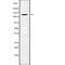 Phosphorylase Kinase Regulatory Subunit Beta antibody, abx217737, Abbexa, Western Blot image 