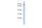 Amyloid Beta Precursor Protein Binding Family B Member 2 antibody, GTX45241, GeneTex, Western Blot image 