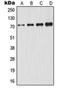 Glutamate-Cysteine Ligase Catalytic Subunit antibody, orb213983, Biorbyt, Western Blot image 