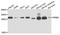 Phosphomannomutase 2 antibody, STJ25035, St John