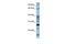 Dolichyldiphosphatase 1 antibody, GTX46054, GeneTex, Western Blot image 