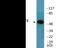 Activating Transcription Factor 2 antibody, EKC2355, Boster Biological Technology, Western Blot image 