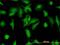 Stress Induced Phosphoprotein 1 antibody, H00010963-M11, Novus Biologicals, Immunocytochemistry image 