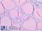 Thyroglobulin antibody, LS-B6055, Lifespan Biosciences, Immunohistochemistry paraffin image 