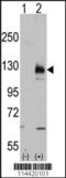 Transient Receptor Potential Cation Channel Subfamily M Member 8 antibody, TA302224, Origene, Western Blot image 