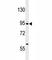 Delta Like Canonical Notch Ligand 4 antibody, F52027-0.4ML, NSJ Bioreagents, Western Blot image 