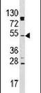 RAC-beta serine/threonine-protein kinase antibody, PA5-13759, Invitrogen Antibodies, Western Blot image 