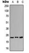 Calcium Voltage-Gated Channel Auxiliary Subunit Gamma 1 antibody, orb213632, Biorbyt, Western Blot image 