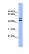 Transmembrane Serine Protease 3 antibody, orb330936, Biorbyt, Western Blot image 