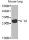 Stanniocalcin 1 antibody, A6755, ABclonal Technology, Western Blot image 