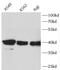 Aprataxin antibody, FNab10359, FineTest, Western Blot image 