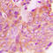 Fyn Related Src Family Tyrosine Kinase antibody, LS-C352208, Lifespan Biosciences, Immunohistochemistry paraffin image 