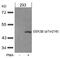 Glycogen Synthase Kinase 3 Beta antibody, AP02535PU-S, Origene, Western Blot image 