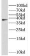 Renin antibody, FNab07240, FineTest, Western Blot image 
