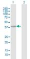 Acyl-CoA Dehydrogenase Family Member 8 antibody, H00027034-D01P, Novus Biologicals, Western Blot image 