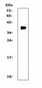 TNF Receptor Superfamily Member 13B antibody, A02952-1, Boster Biological Technology, Western Blot image 