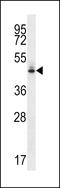 SED1 antibody, LS-C164929, Lifespan Biosciences, Western Blot image 