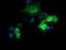 Parvin Alpha antibody, MA5-26239, Invitrogen Antibodies, Immunocytochemistry image 