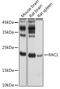 Rac Family Small GTPase 1 antibody, GTX55772, GeneTex, Western Blot image 