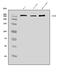 Dysferlin antibody, A01234-3, Boster Biological Technology, Western Blot image 