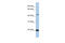 Zinc Finger Protein 581 antibody, 25-299, ProSci, Enzyme Linked Immunosorbent Assay image 