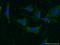 Vitronectin antibody, 15833-1-AP, Proteintech Group, Immunofluorescence image 