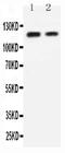 Cadherin 3 antibody, PA5-79023, Invitrogen Antibodies, Western Blot image 