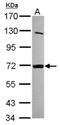 Myotubularin Related Protein 8 antibody, NBP2-15027, Novus Biologicals, Western Blot image 