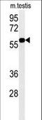 Dyskerin Pseudouridine Synthase 1 antibody, LS-C167426, Lifespan Biosciences, Western Blot image 