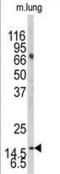 Microtubule Associated Protein 1 Light Chain 3 Beta antibody, LS-C165705, Lifespan Biosciences, Western Blot image 