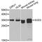 Superoxide Dismutase 3 antibody, A6984, ABclonal Technology, Western Blot image 