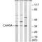 Carbonic Anhydrase 5A antibody, A09582, Boster Biological Technology, Western Blot image 