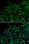Toll Like Receptor 7 antibody, LS-C331192, Lifespan Biosciences, Immunofluorescence image 