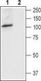 Transient Receptor Potential Cation Channel Subfamily V Member 4 antibody, TA328772, Origene, Western Blot image 