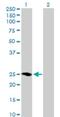 Muscle RAS Oncogene Homolog antibody, H00022808-B01P, Novus Biologicals, Western Blot image 