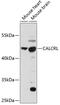 Calcitonin Receptor Like Receptor antibody, 14-214, ProSci, Western Blot image 