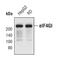 Eukaryotic Translation Initiation Factor 4 Gamma 1 antibody, PA5-17140, Invitrogen Antibodies, Western Blot image 