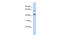 NAD Kinase 2, Mitochondrial antibody, 26-749, ProSci, Western Blot image 