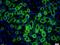 Hepsin antibody, orb100345, Biorbyt, Immunohistochemistry paraffin image 