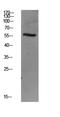 SMAD Family Member 3 antibody, STJ99613, St John