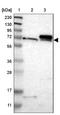 Translocase Of Outer Mitochondrial Membrane 70 antibody, NBP1-87863, Novus Biologicals, Western Blot image 