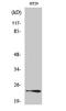 Ras-related protein Rab-7L1 antibody, A08450-1, Boster Biological Technology, Western Blot image 