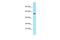 DEAD-Box Helicase 19B antibody, PA5-68735, Invitrogen Antibodies, Western Blot image 