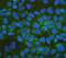 Aldehyde Dehydrogenase 1 Family Member A1 antibody, A01392, Boster Biological Technology, Immunofluorescence image 