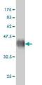 Fibroblast Growth Factor Receptor 2 antibody, ab58201, Abcam, Western Blot image 